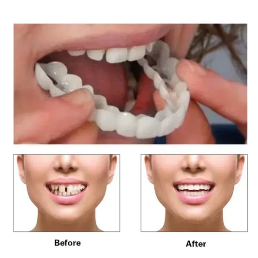 Silicone Denture Set Fit Temporary Orthodontic Teeth Dentures Fake Tooth Oral Hygiene Care Whitening Dentures Simulation Braces