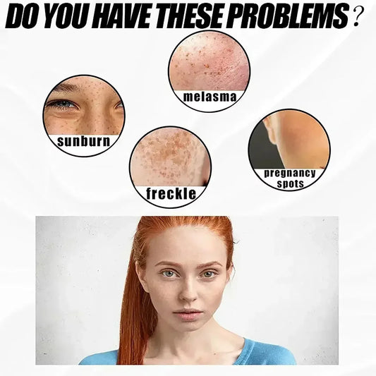 eelhoe Niacinamide Melasma Brightening Cream Reduce Melanin