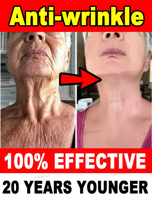 No wrinkles, 20 years younger
