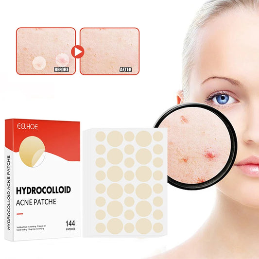 Face Skin Care Acne Pimple Spot Sticker Covering